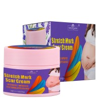 Effective  Remove Pregnancy Scars Acne Cream Stretch Mark Treatment Maternity Repair Anti-Aging Anti-Winkle Firming Body Cream
