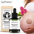 JoyPretty Maternity Stretch Marks Remover Oil Pregnancy Body Skin Care Essential Oil Stretch Mark Removal Cream Treatment 50ml