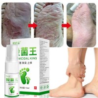 Herbal Anti Fungal Foot Spray Sterilize Spray Infection Toe Treatment Onychomycosis Anti Bacterial Foot Repair Cream