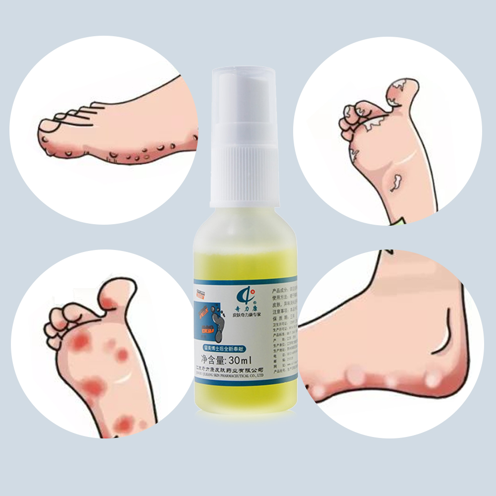 Foot Odor Treatment Cream Anti bacterial Anti Itching Odor Care   Fungal Repair Beriberi Foot Cream Chinese Medicinal Cream