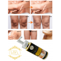 DOUBLE GLUTATHIONE INJECTION, ENRICHED WITH ALPHA ARBUTIN, COLLAGEN, VITAMIN B3 | CRISMYLA